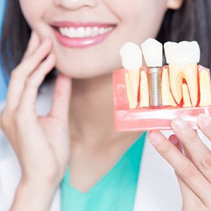 a person holding a model of a dental implant