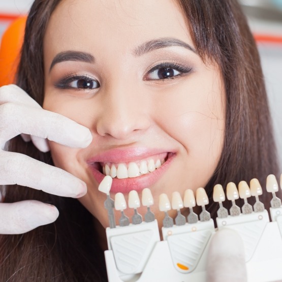 Color matching female patients teeth for veneers