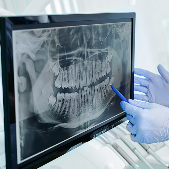 Close up of dentist looking at dental X ray