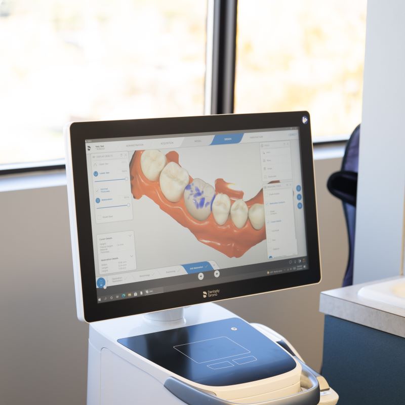 Digital dental impression of teeth on computer monitor